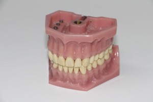 dentures-1514697_640